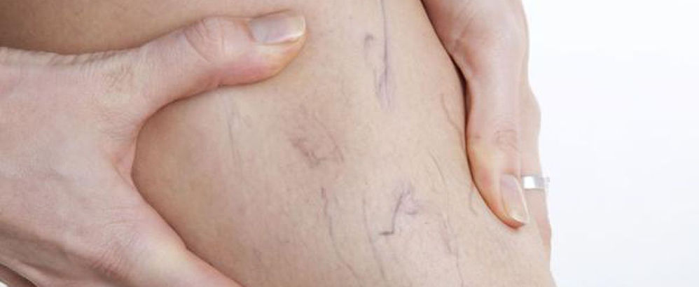 before after gallery